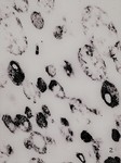First electron micrograph of a lysosome-rich fraction by The Journal of Biophysical and Chemical Cytology