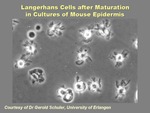 Langerhans Cells after Maturation by The Rockefeller University