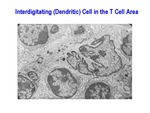 Interdigitating (Dendritic) Cell in the T Cell Area