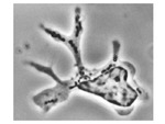 Phase-Contrast Micrograph of a Dendritic Cell by The Rockefeller University