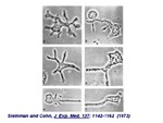 Phase-Contrast Micrographs of Dendritic Cells from Mouse Lymphoid Organs by The Rockefeller University